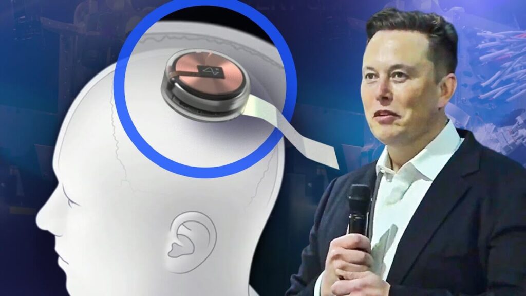 Elon Musk Neuralink